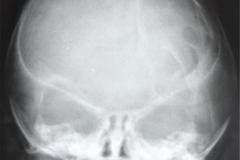 signo-de-plata-martillada-000