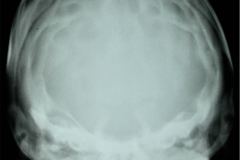 signo-de-plata-martillada-005
