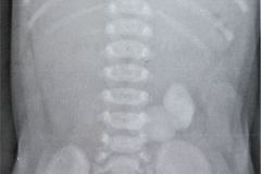 silueta-munon-cordon-umbilical-001