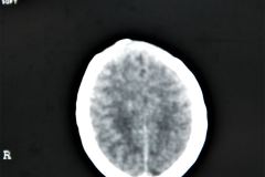 tac-cerebral-normal-1998-12-22-h.-nidia-perez-019