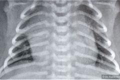 timo-imagen-cardiotimica-normal-000