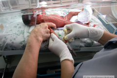 toma-muestra-laboratorio-angulo-codo-2002-000