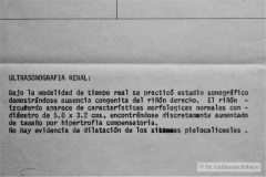 turner-monosomia-xo-1984-050