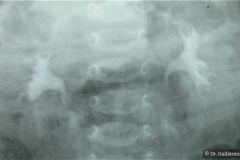 urografia-normal-1988-000