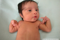 vater-atresia-esofago-fisutla-traqueoesofagica-anomalias-extremidades-2004-011